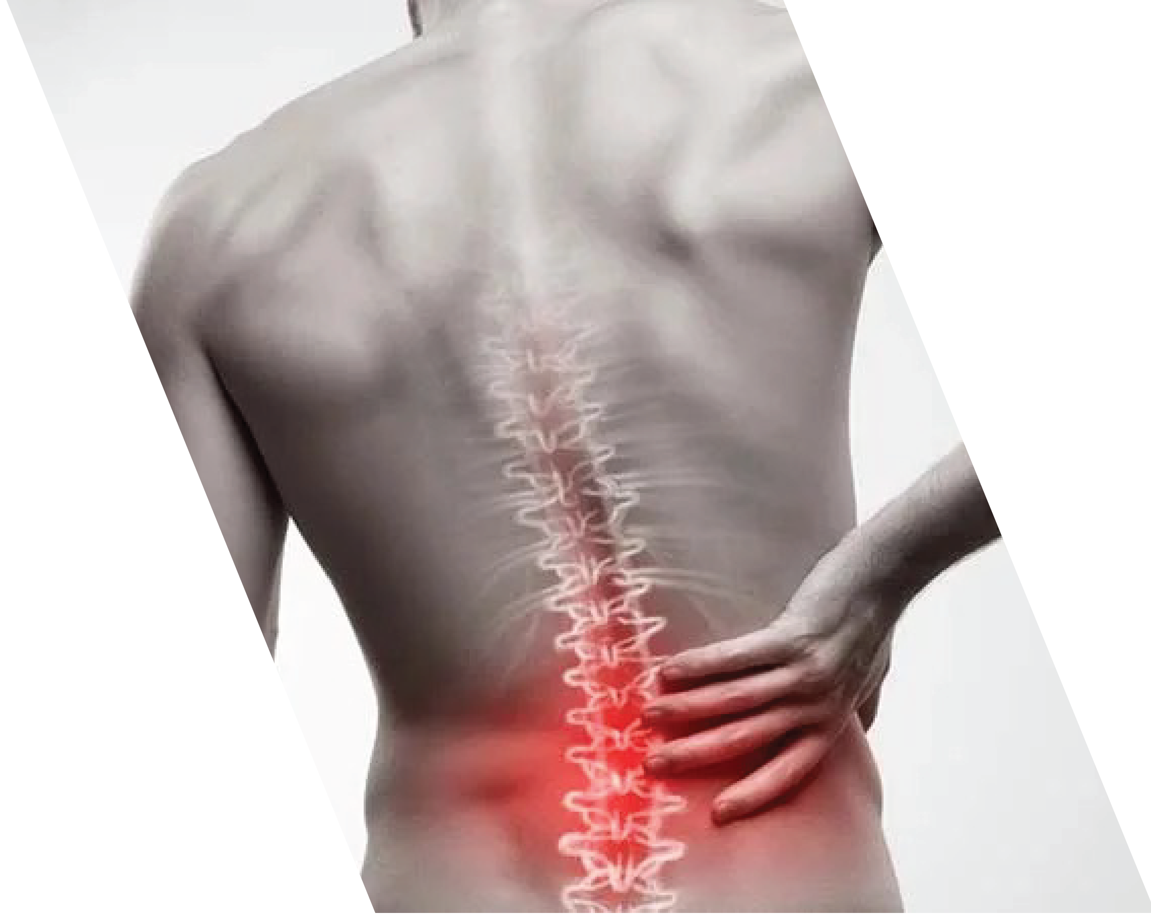 BACK PAIN